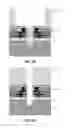 Fig. 11 - ACTIVE MICRO SIEVE AND METHODS FOR BIOLOGICAL APPLICATIONS