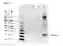 Fig. 24 - AGENTS, KITS AND METHODS FOR COMPLEMENT FACTOR H-RELATED PROTEIN 1 DETECTION
