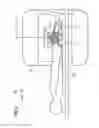 Fig. 06 - Displaceable local coil
