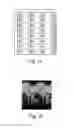 Fig. 02 - Magnetic resonance imaging method and apparatus
