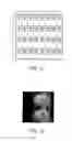 Fig. 03 - Magnetic resonance imaging method and apparatus