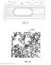 Fig. 07 - INTEGRATED TORQUE JACKET SYSTEMS AND METHODS FOR OCT