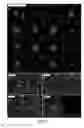 Fig. 05 - High throughput multichannel fluorescence microscopy with microlens arrays