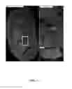 Fig. 06 - High throughput multichannel fluorescence microscopy with microlens arrays
