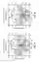 Fig. 07 - Pair of progressive ophthalmic lenses