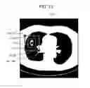Fig. 72 - Control method and non-transitory computer-readable recording medium for comparing medical images