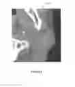 Fig. 04 - Method and apparatus for learning-enhanced atlas-based auto-segmentation