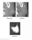 Fig. 08 - Method and apparatus for learning-enhanced atlas-based auto-segmentation