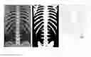 Fig. 01 - Method, apparatus and system for identifying a specific part of a spine in an image