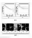Fig. 02 - Quantitative predictors of tumor severity