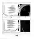 Fig. 07 - Quantitative predictors of tumor severity