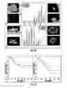 Fig. 15 - Quantitative predictors of tumor severity