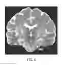 Fig. 06 - MEDICAL IMAGE PROCESSING
