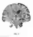 Fig. 07 - MEDICAL IMAGE PROCESSING