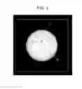 Fig. 05 - METHOD AND APPARATUS FOR SENSING MOVING BALL, AND IMAGE PROCESSING METHOD OF BALL IMAGE FOR CALCULATION OF SPIN OF MOVING BALL