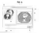 Fig. 09 - X-ray CT apparatus and image reconstruction method