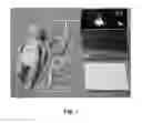 Fig. 02 - Virtual neonatal echocardiographic training system