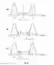 Fig. 05 - Reference current generation in resistive memory device