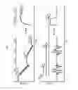 Fig. 15 - Battery control device