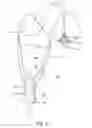 Fig. 13 - Accessory for mobile electronic device