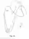 Fig. 18 - Accessory for mobile electronic device
