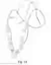 Fig. 19 - Accessory for mobile electronic device