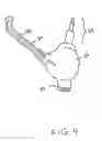 Fig. 05 - Earbud cable management device