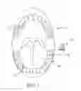 Fig. 02 - Methods and apparatus for transmitting vibrations