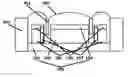 Fig. 01 - MAGNET ASSEMBLY AND SPEAKER COMPRISING THE ASSEMBLY