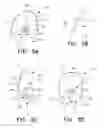 Fig. 06 - Oriole jelly birdfeeder