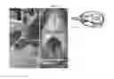 Fig. 08 - ANIMAL MODEL FOR EVALUATING PERFORMANCE OF HEMOSTATIC AGENT FOR INDUCING HEMORRHAGE IN COMMON CAROTID ARTERY OR SUPERIOR SAGITTAL SINUS, AND USE THEREOF