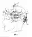 Fig. 03 - Headgear for protective headwear