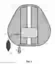 Fig. 03 - Vertical back support health-enhancing device