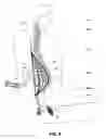 Fig. 09 - Vertical back support health-enhancing device