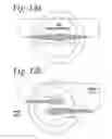 Fig. 10 - Passive encasement zipper containment system