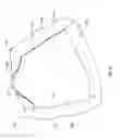 Fig. 09 - Cushion covers, cushions, and methods of using the same