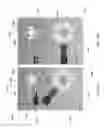 Fig. 10 - Endoscope control unit with braking system