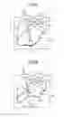 Fig. 06 - ENDOSCOPE, PARTICULARLY FOR MINIMALLY INVASIVE SURGERY