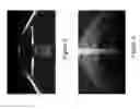 Fig. 04 - Procedural optical coherence tomography (OCT) for surgery and related methods