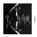 Fig. 05 - Procedural optical coherence tomography (OCT) for surgery and related methods