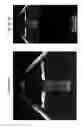 Fig. 06 - Procedural optical coherence tomography (OCT) for surgery and related methods