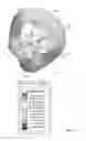 Fig. 12 - Wearable device assembly having antenna