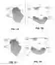Fig. 09 - Body structure imaging