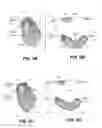 Fig. 10 - Body structure imaging