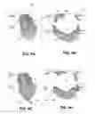 Fig. 11 - Body structure imaging