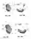 Fig. 12 - Body structure imaging