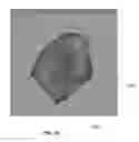 Fig. 17 - Body structure imaging