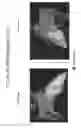 Fig. 18 - Body structure imaging