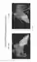 Fig. 20 - Body structure imaging