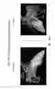 Fig. 22 - Body structure imaging